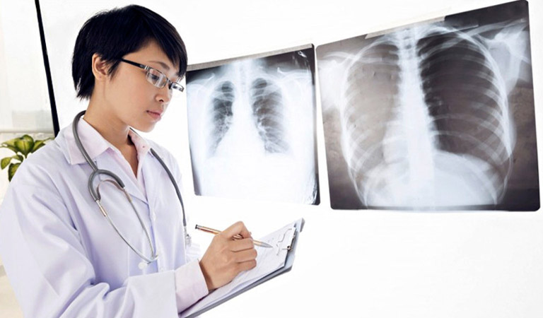 Hình ảnh chụp X-quang giúp bác sĩ dễ dàng chẩn đoán bệnh