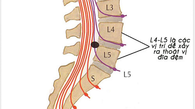 L4 L5 là 2 đốt sống ở vị trí thấp nhất của cột sống thắt lưng